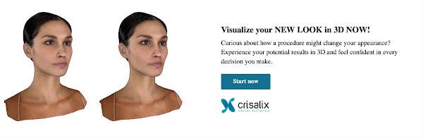 Bannière web Crisalix en ligne - Face