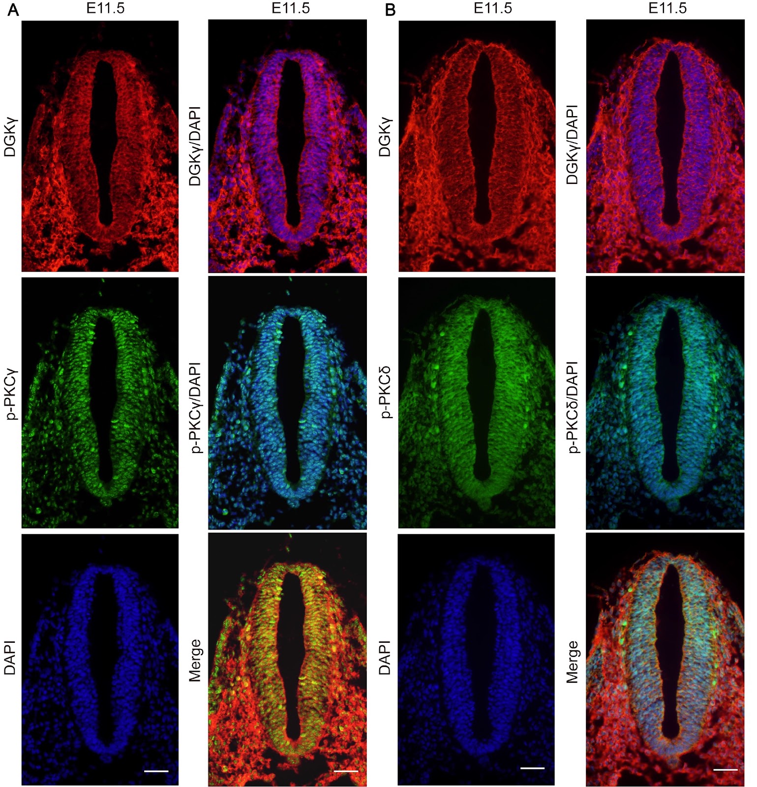 Diacylglycerol kinase γ facilitates the proliferation and migration of neural stem cells in the developing neural tube