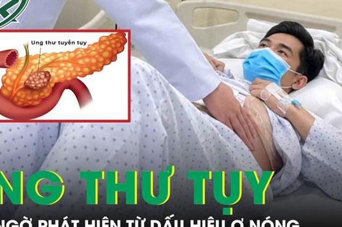 Người đàn ông 57 tuổi phát hiện ung thư tụy từ dấu hiệu ợ nóng - Báo Sức Khỏe &amp; Đời Sống