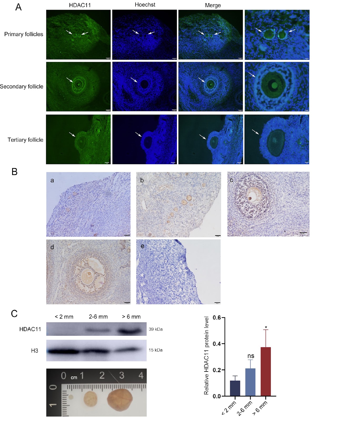 HDAC11 in ovarian granulosa cells coordinates LH in the maturation of oocytes in Tan sheep