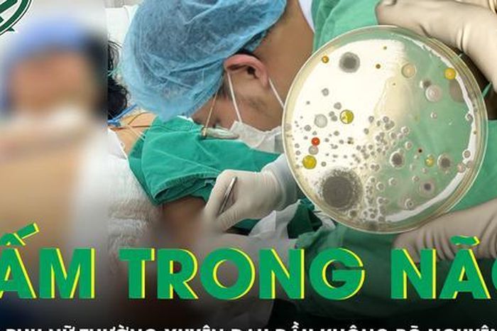 Đau đầu nhiều ngày, người phụ nữ bất ngờ phát hiện nấm nguy hiểm trong não - Báo Sức Khỏe &amp; Đời Sống