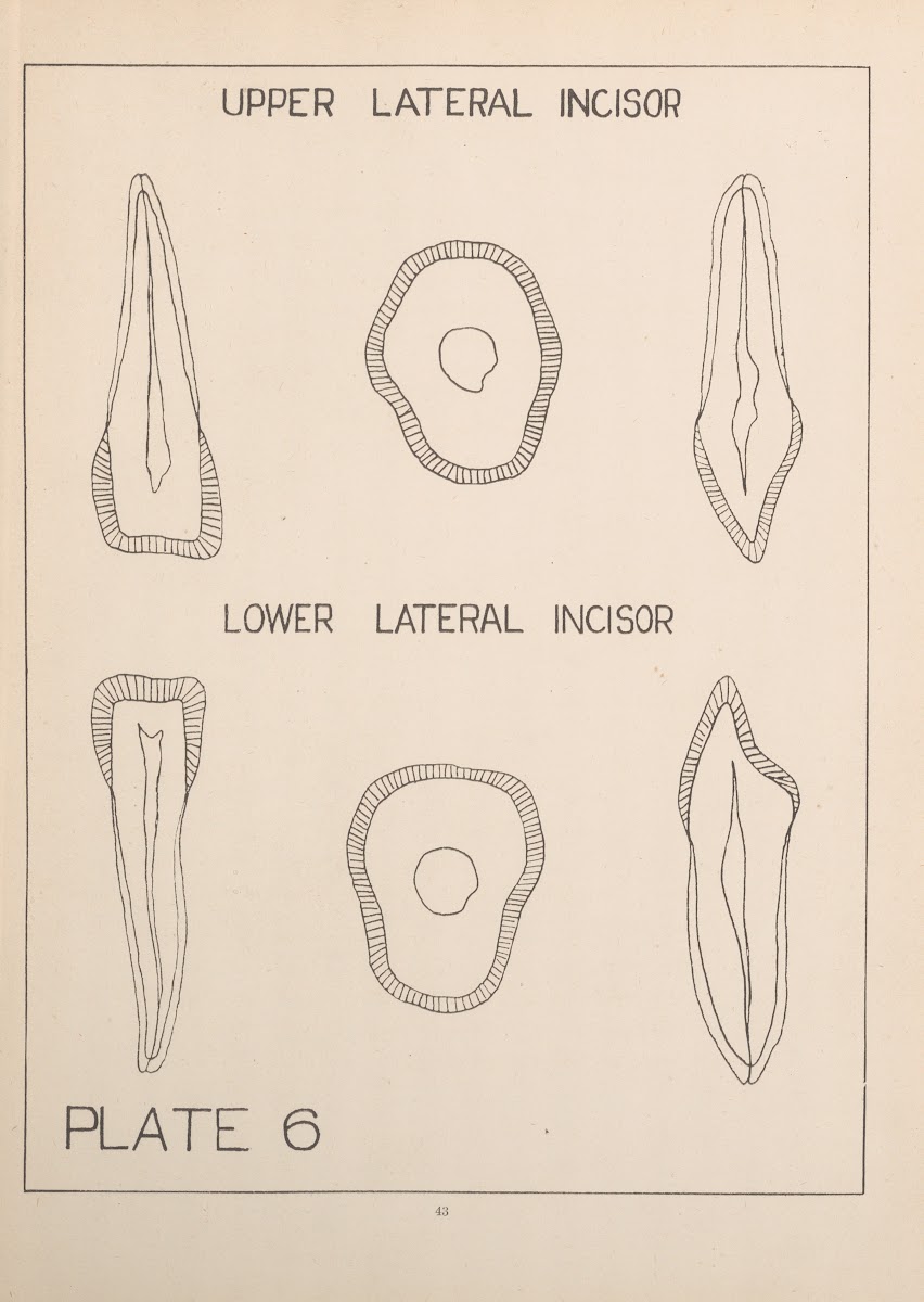 Upper And Lower Lateral Incisors 1924