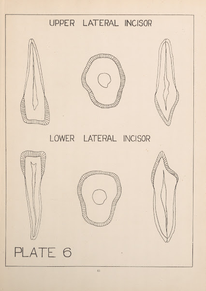 Upper And Lower Lateral Incisors 1924