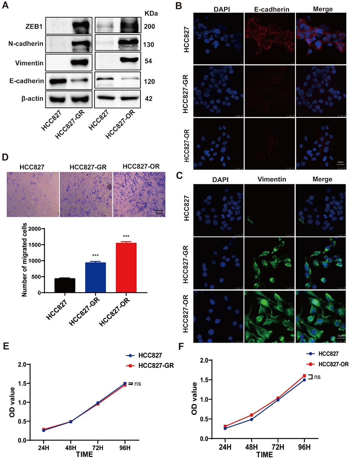 CCL2 promotes EGFR-TKIs resistance in non-small cell lung cancer via the AKT-EMT pathway