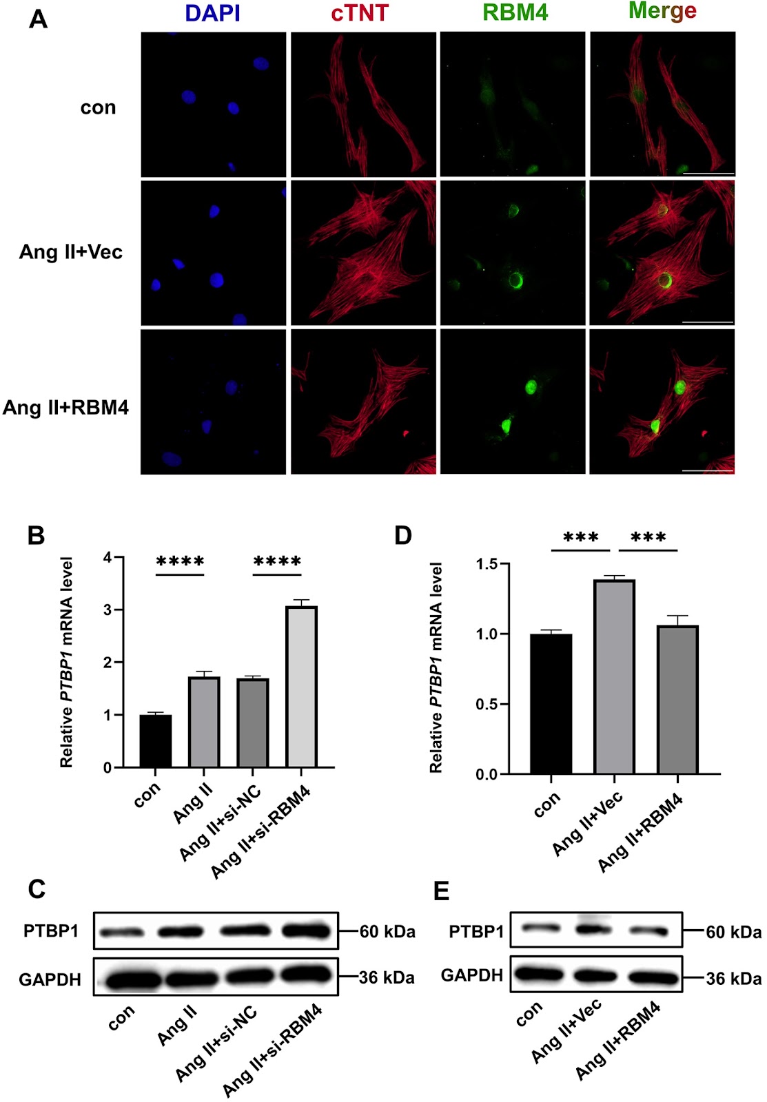 Endogenous RBM4 prevents Ang II-induced cardiomyocyte hypertrophy via downregulating the expression of PTBP1