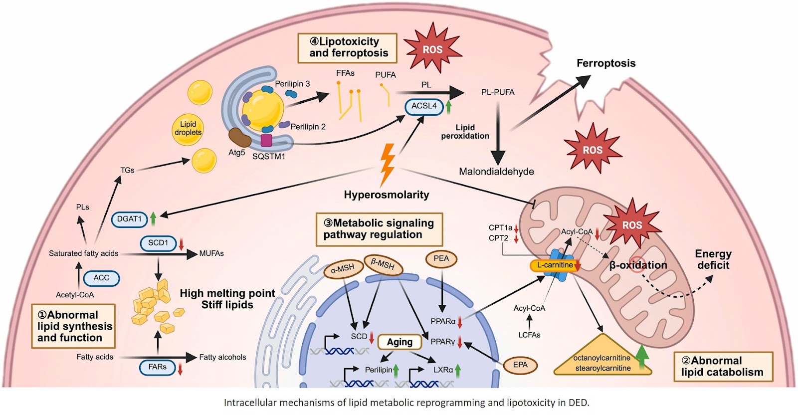 Lipid metabolism dysregulation in  dry eye disease