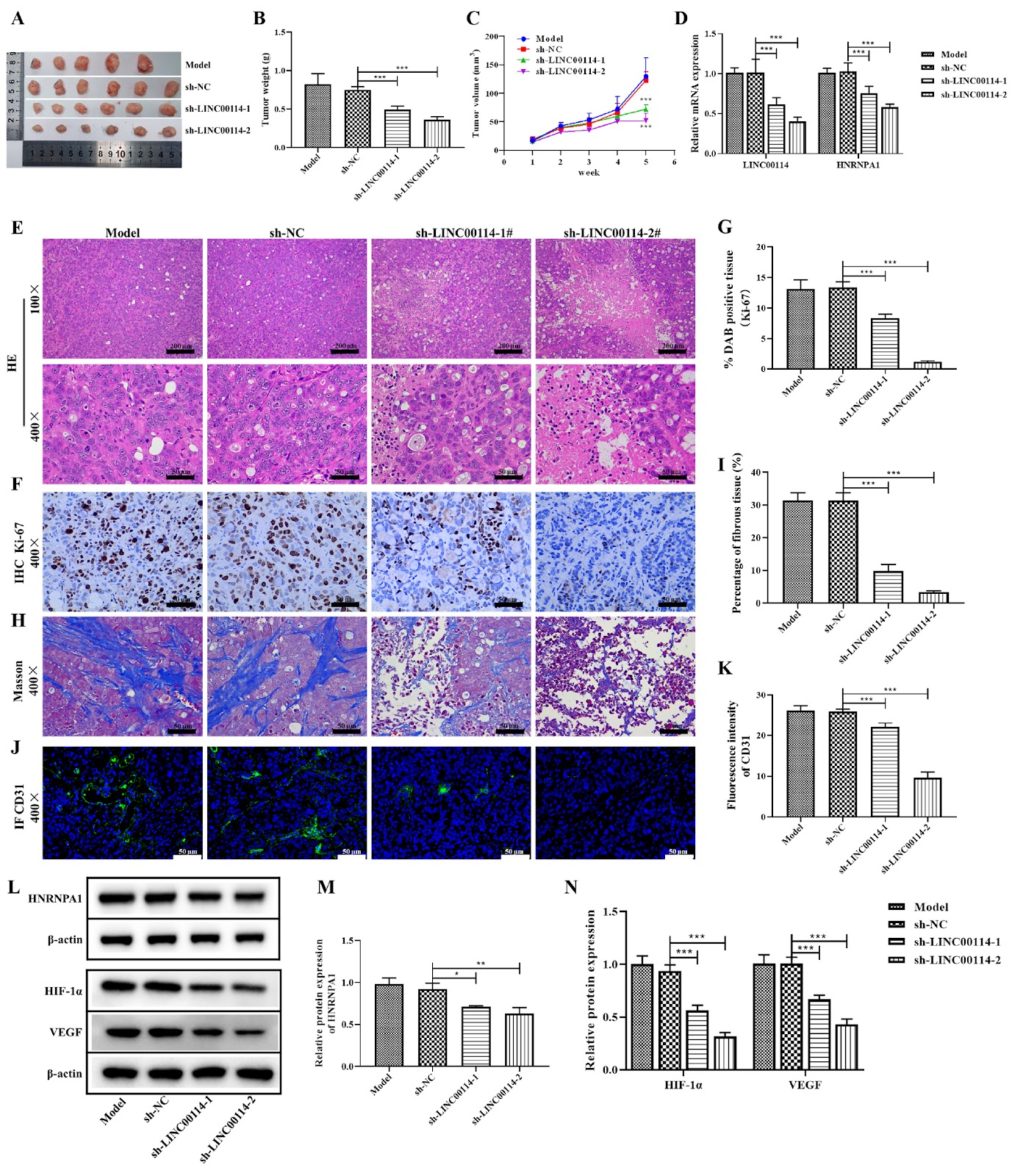 LINC00114 Promotes Colorectal Cancer Metastasis by Targeting HNRNPA1 to Regulate Glutamine Metabolism Reprogramming and Angiogenesis