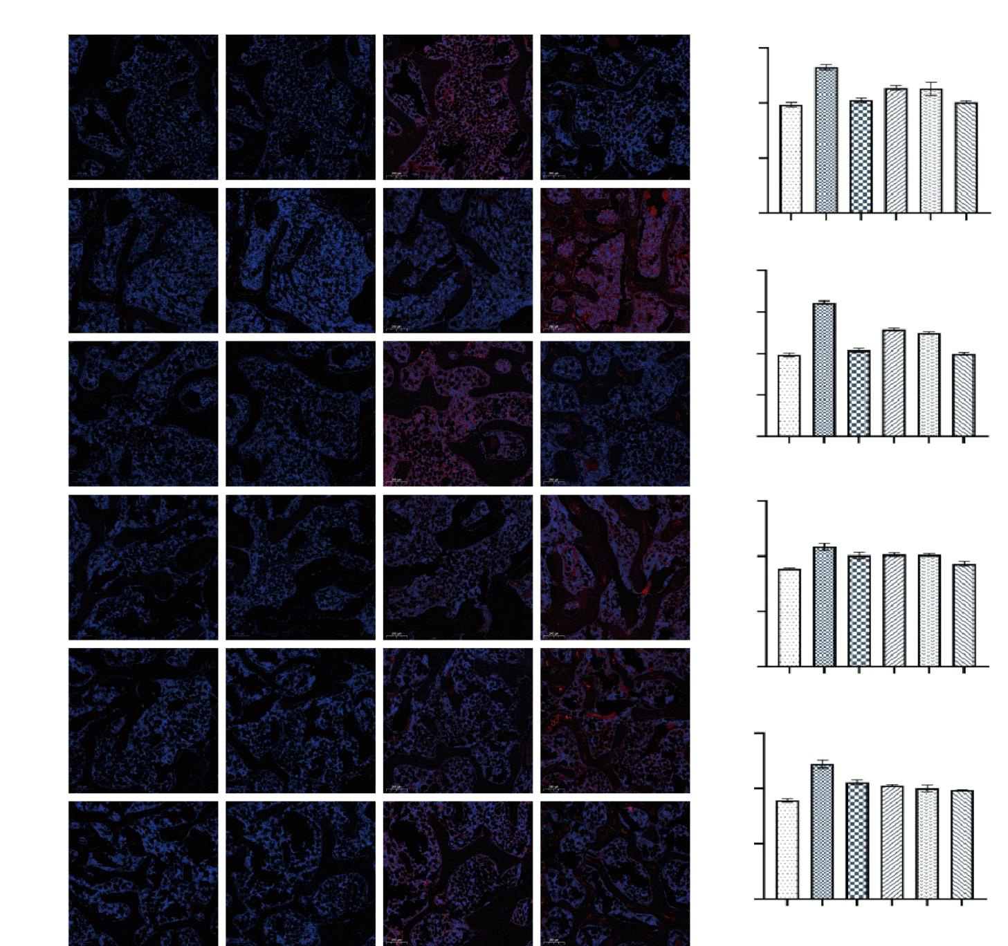 Mechanistic Investigation of Aconitine Combined with Paeoniflorin Against Knee Osteoarthritis via the Ihh-Gli Signaling Pathway
