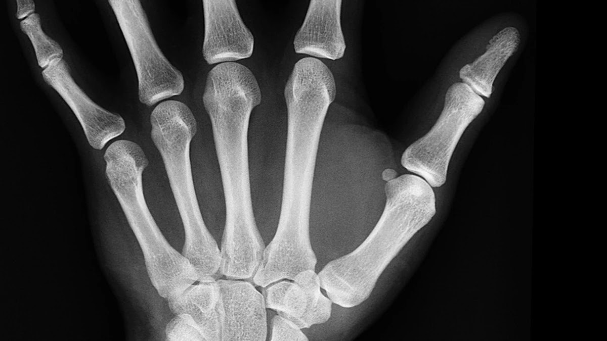 실손보험 청구 시 꼭 확인해야 할 서류와 절차