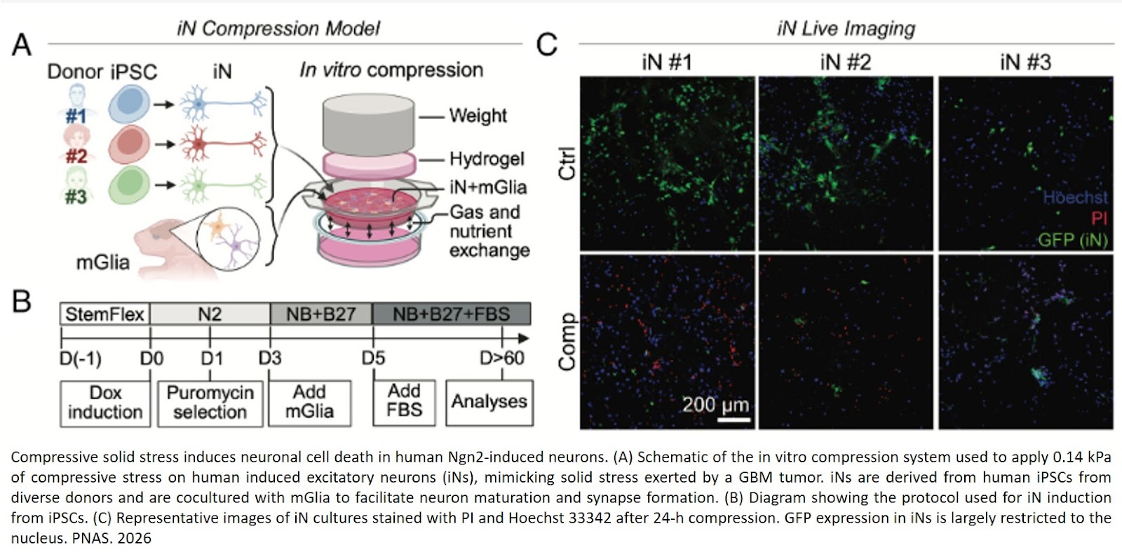 Mechanical compression induces neuronal apoptosis, reduces synaptic activity, and promotes glial neuroinflammation in mice and humans