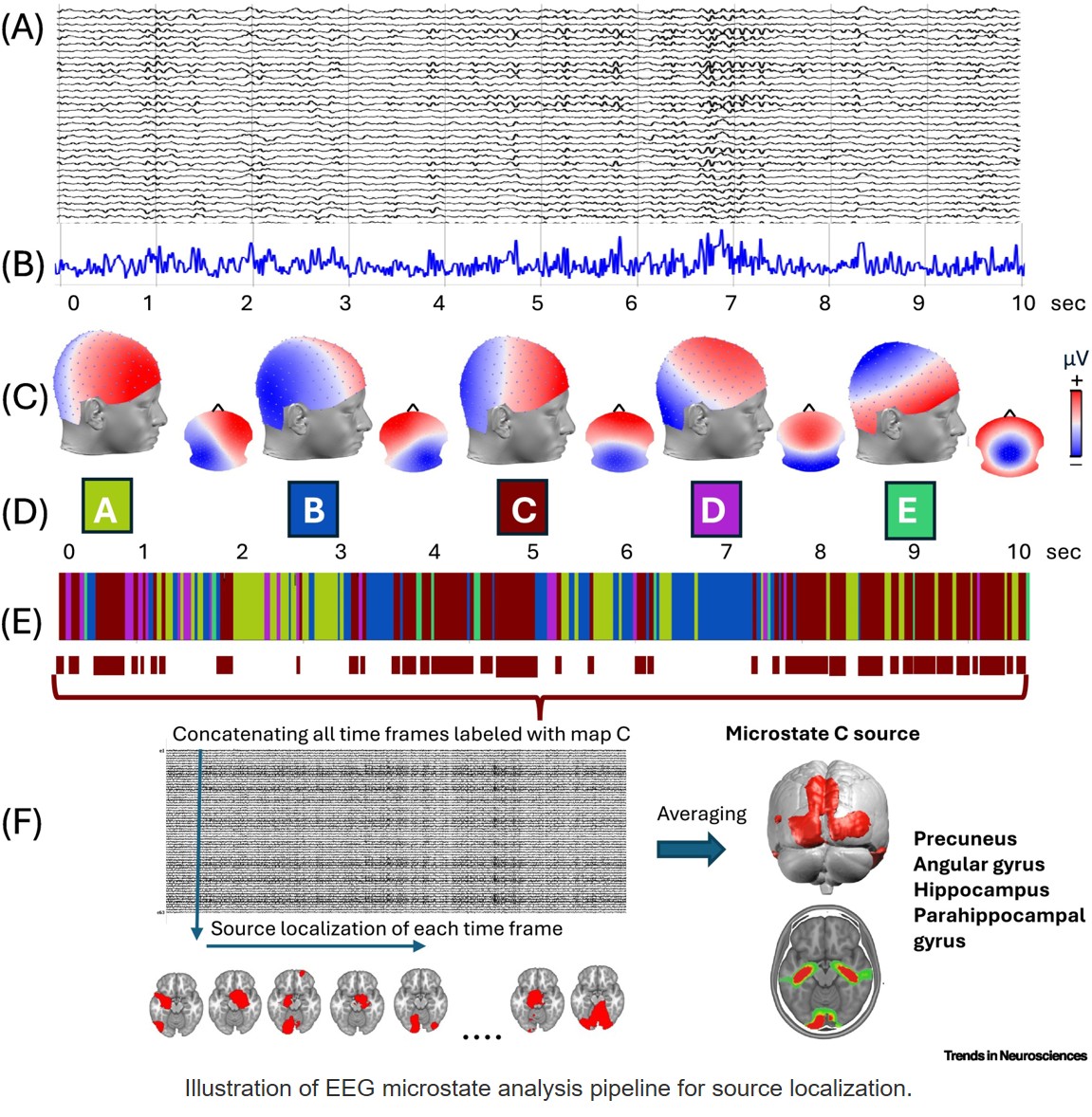 EEG microstates: from methodological foundations to clinical translation