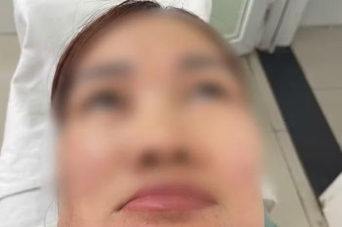 Người phụ nữ 37 tuổi mặt sưng vù, không ăn uống được vì tự ý nặn mụn - Báo Tri thức &amp; Cuộc sống