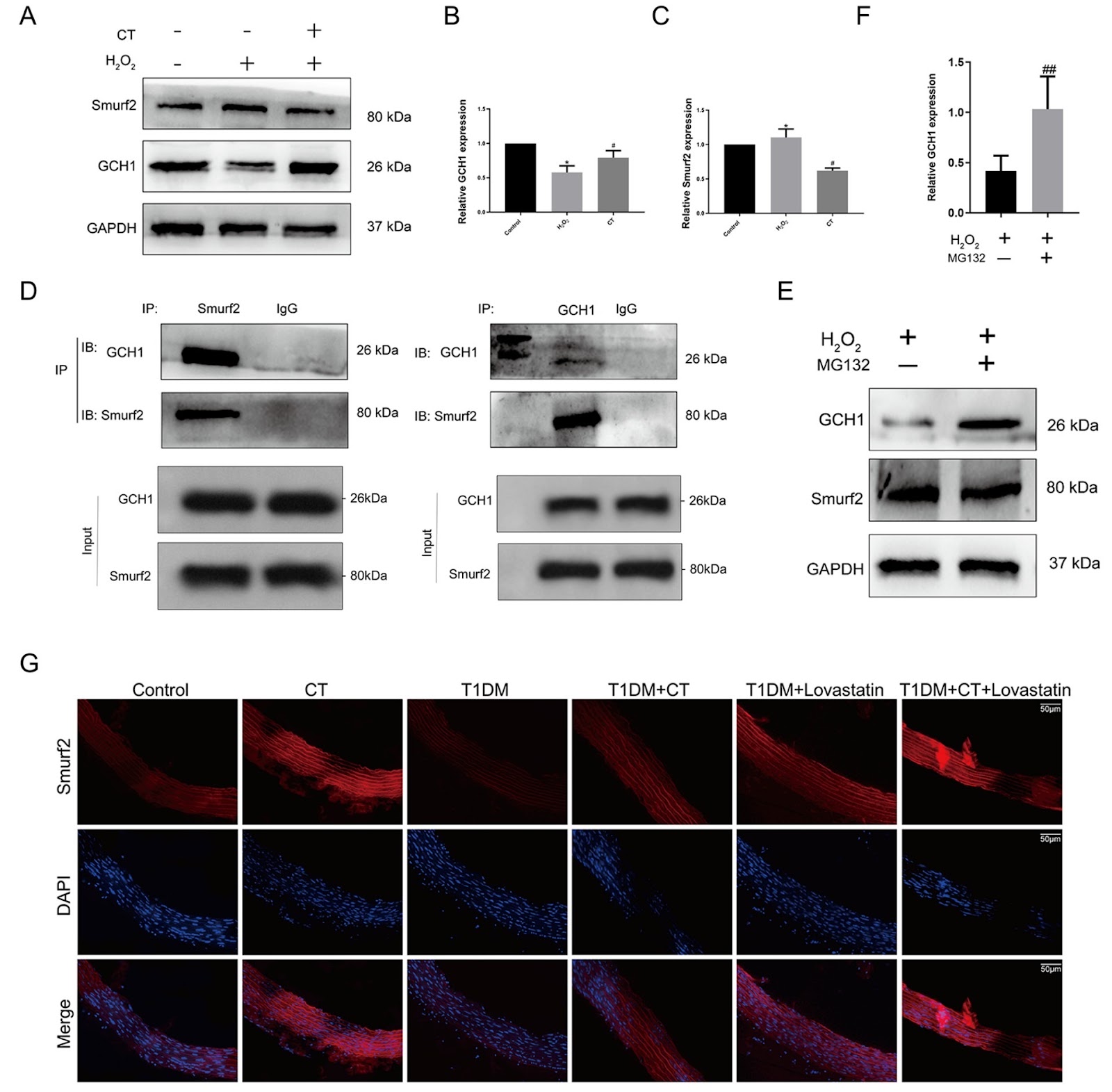 Citronellal improves endothelial dysfunction by affecting the stability of the GCH1 protein