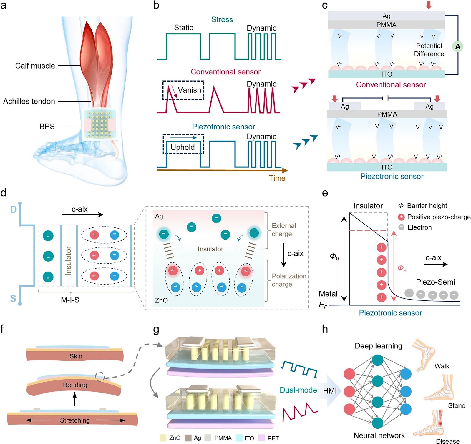 Piezotronic Sensor for Bimodal Monitoring of Achilles Tendon Behavior