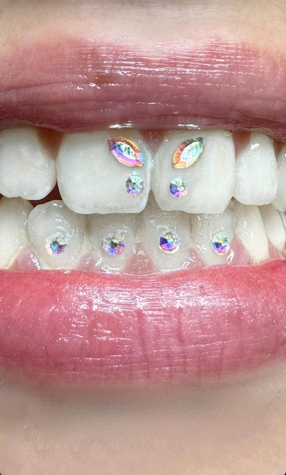 Composición de gemas dentales