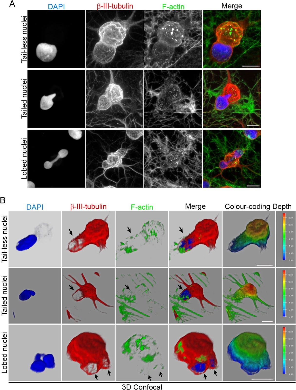 The nuclei of human adult stem cells can move within the cell and generate cellular protrusions to contact other cells