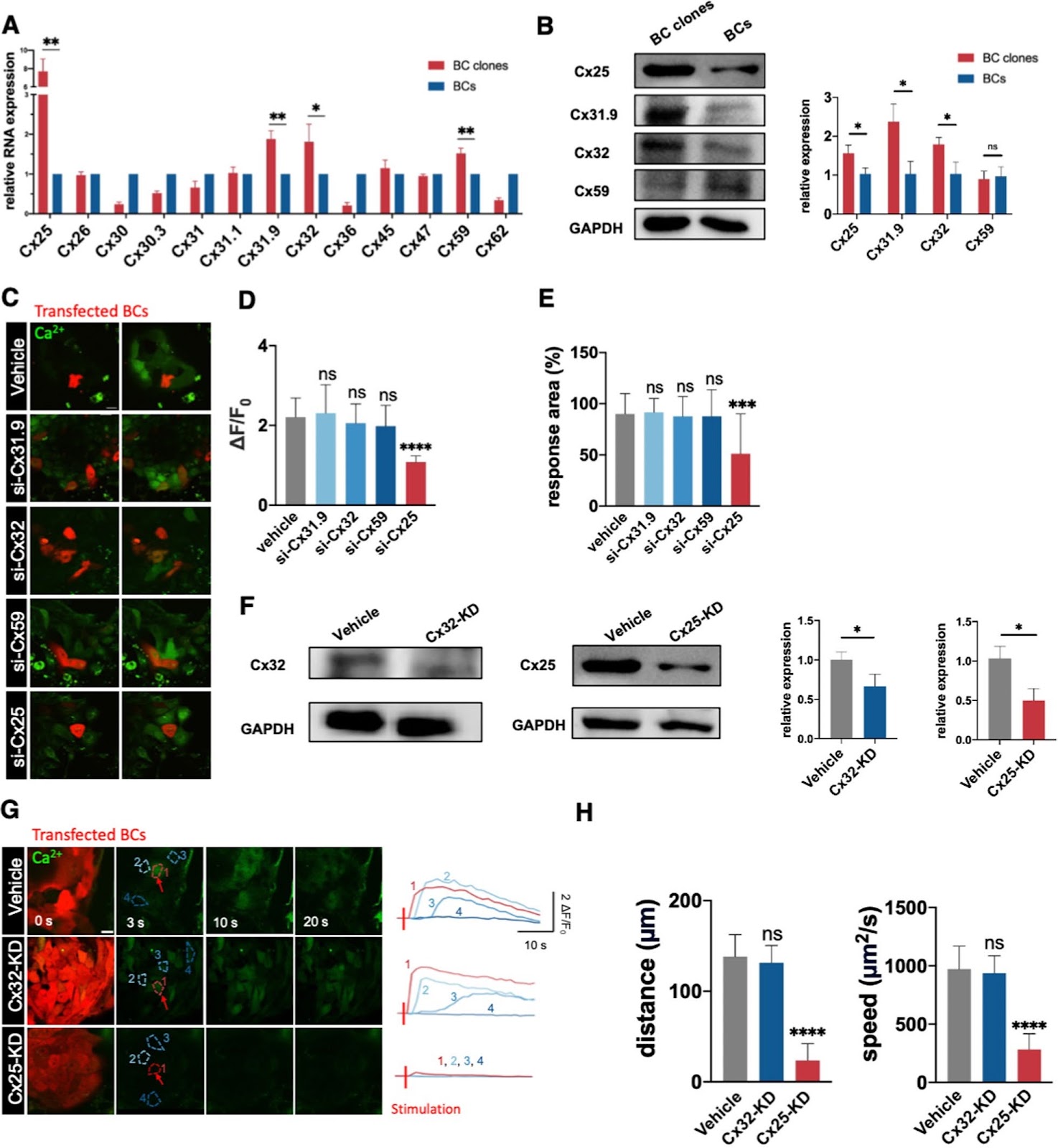 Connexin 25 maintains self-renewal and functions of airway basal cells for airway regeneration
