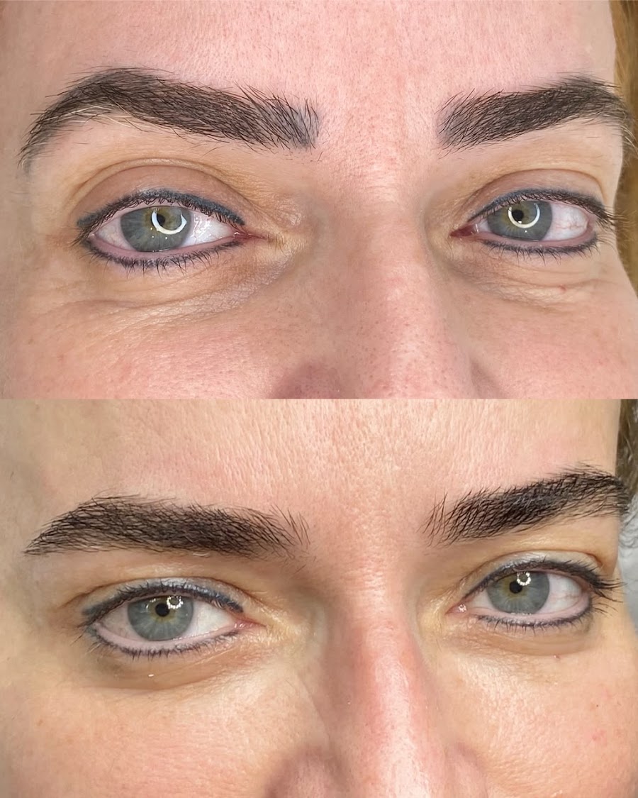Antes e depois — reconstrução de sobrancelhas naturais