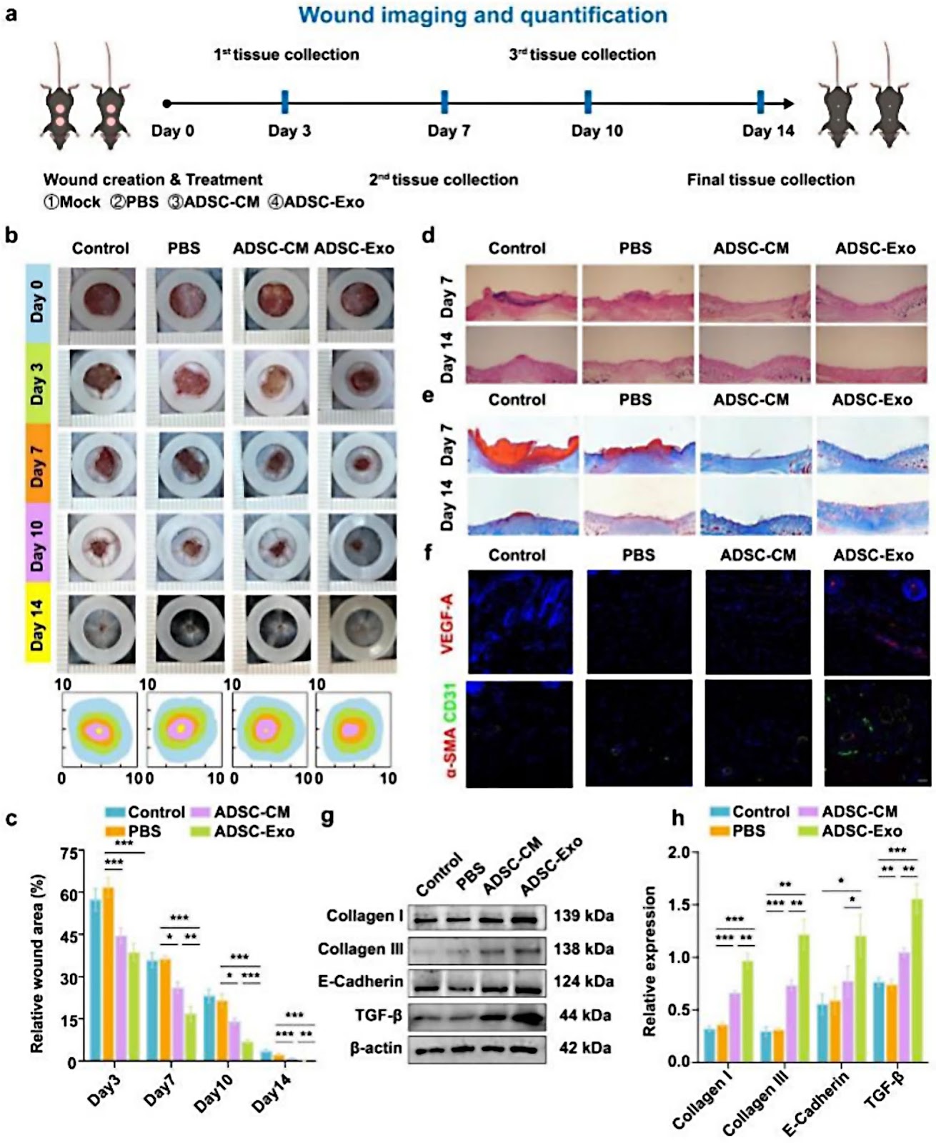Exosomes from adipose-derived stem cells accelerate wound healing by increasing the release of IL-33 from macrophages