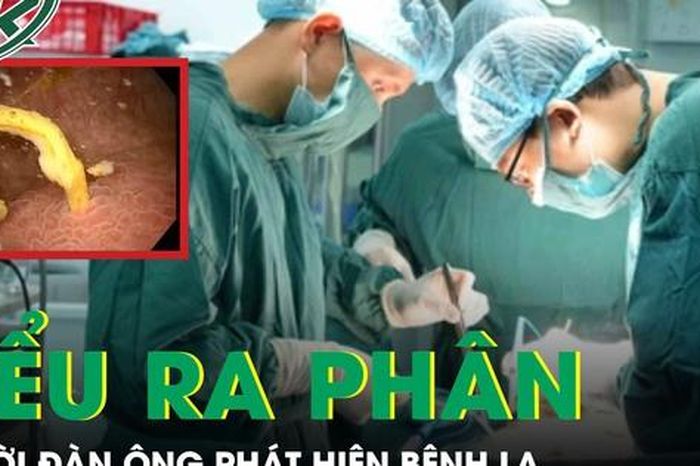 Người đàn ông tiểu ra phân, được phát hiện mắc bệnh lạ - Báo Sức Khỏe &amp; Đời Sống