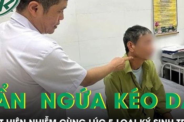 Ngứa suốt nửa năm, người đàn ông phát hiện nhiễm cùng lúc 5 loại ký sinh trùng - Báo Sức Khỏe &amp; Đời Sống