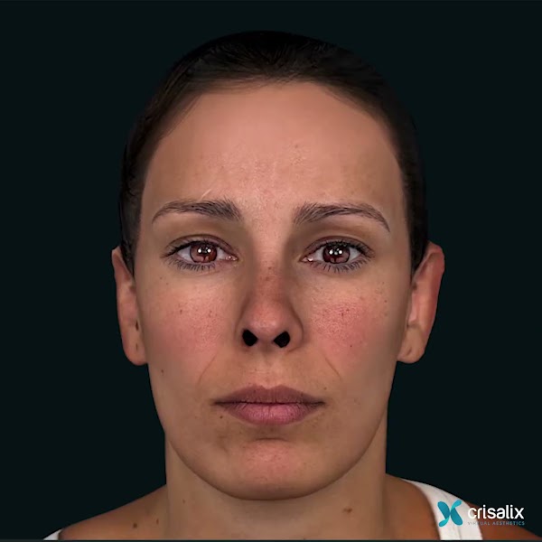 3D face
