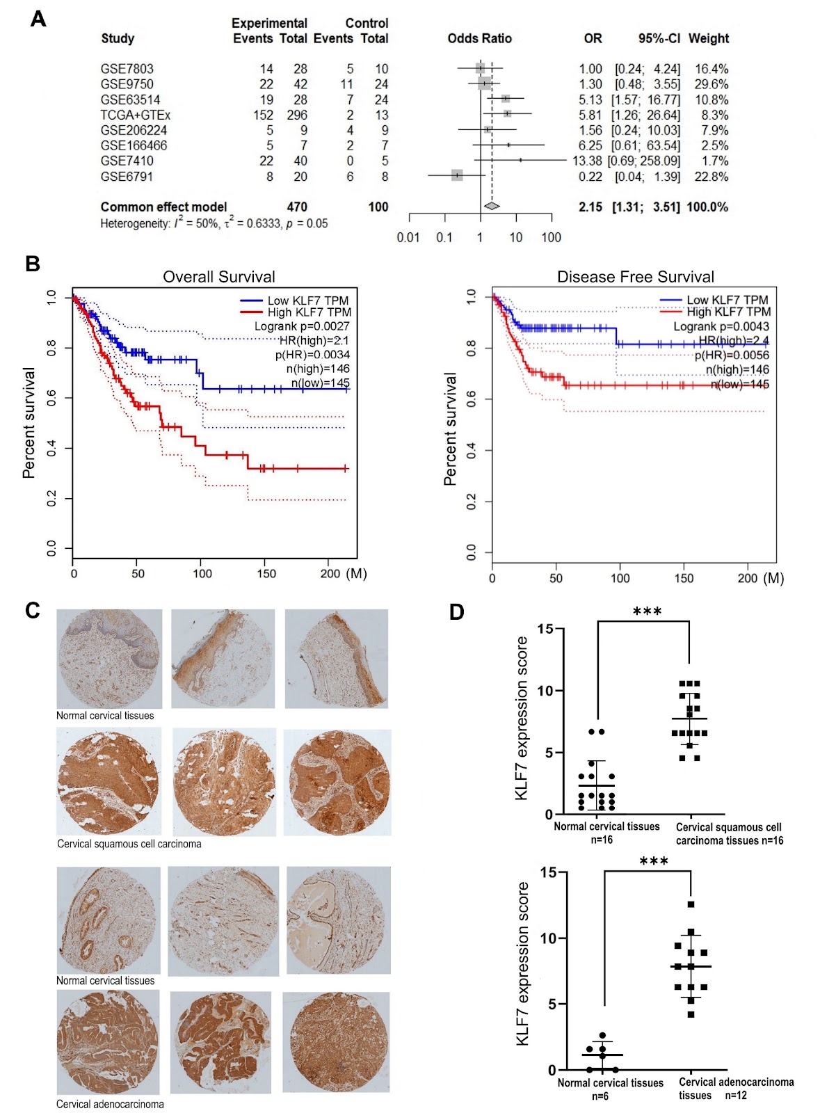 Alpha-lipoic acid targets KLF7 expression to inhibit cervical cancer progression