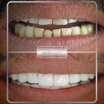 Hollywood smile Nigeria medical tourism Beirut Lebanon — Smile Infinity Dr. Habib Zarifeh