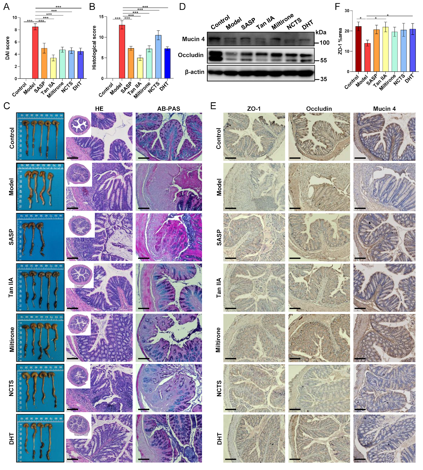 Tanshinones from Salvia miltiorrhiza alleviate ulcerative colitis via reprogramming the gut microbiota-metabolite axis