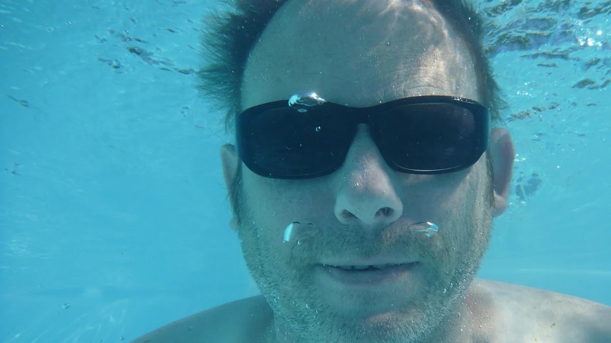 코골이 치료 방법별 효과와