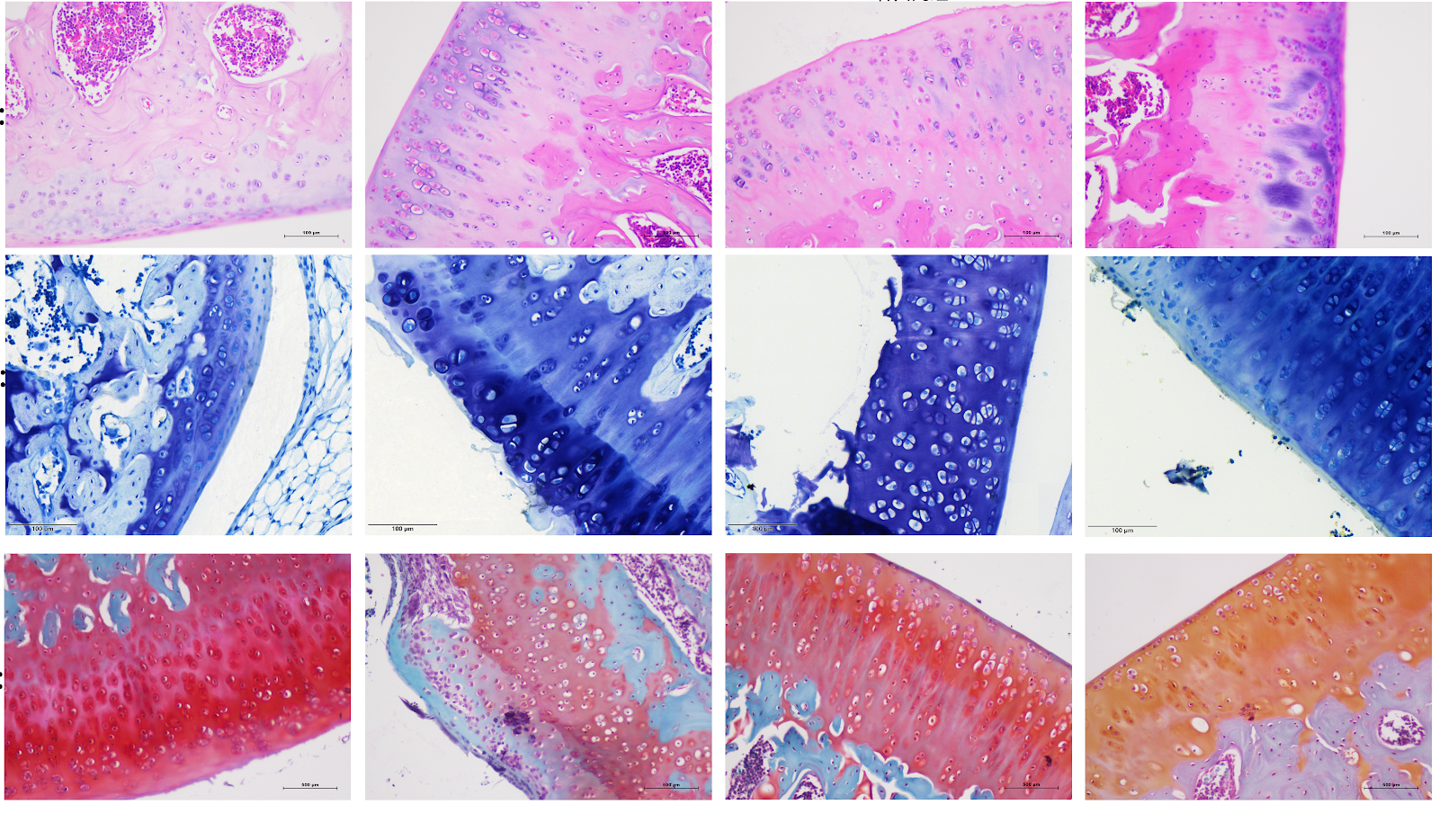 Mechanism by which Yougui Pill inhibits pyroptosis of chondrocytes in rats with knee osteoarthritis
