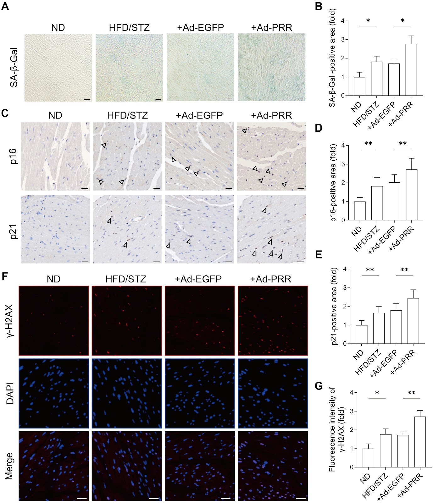 (Pro)renin receptor promotes cardiomyocyte senescence via tripartite motif-containing 24-mediated stabilization of p53 in diabetic cardiomyopathy