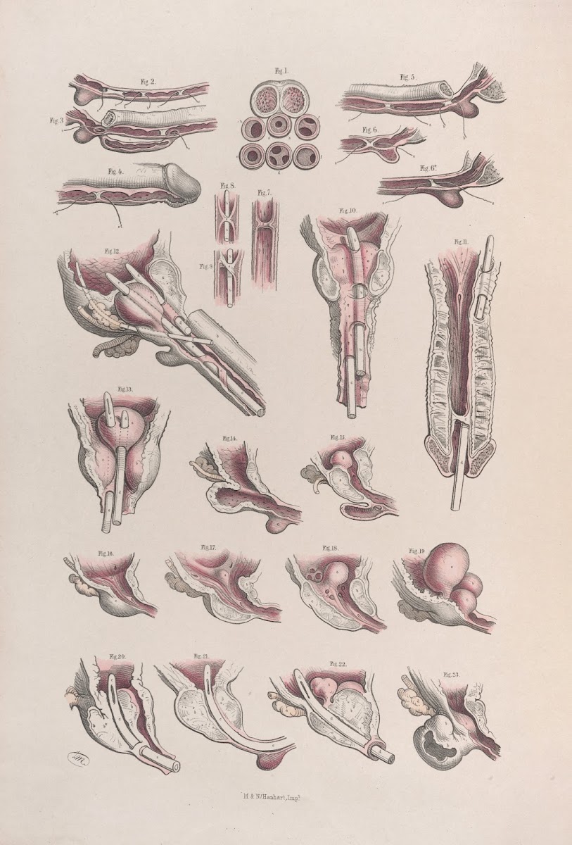 Surgical anatomy Pl45 1856