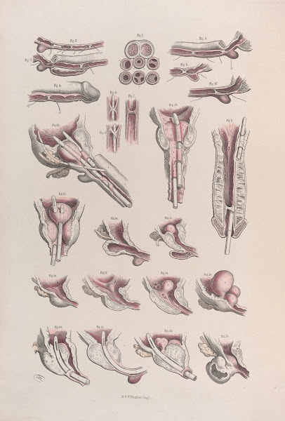 Surgical anatomy Pl45 1856