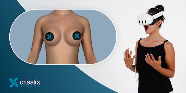 Patient regardant une simulation 3D en réalité virtuelle à l’aide de Crisalix.