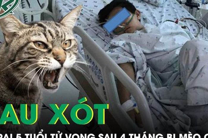 Đau xót: Bé trai 5 tuổi tử vong sau 4 tháng bị mèo cào - Báo Sức Khỏe &amp; Đời Sống