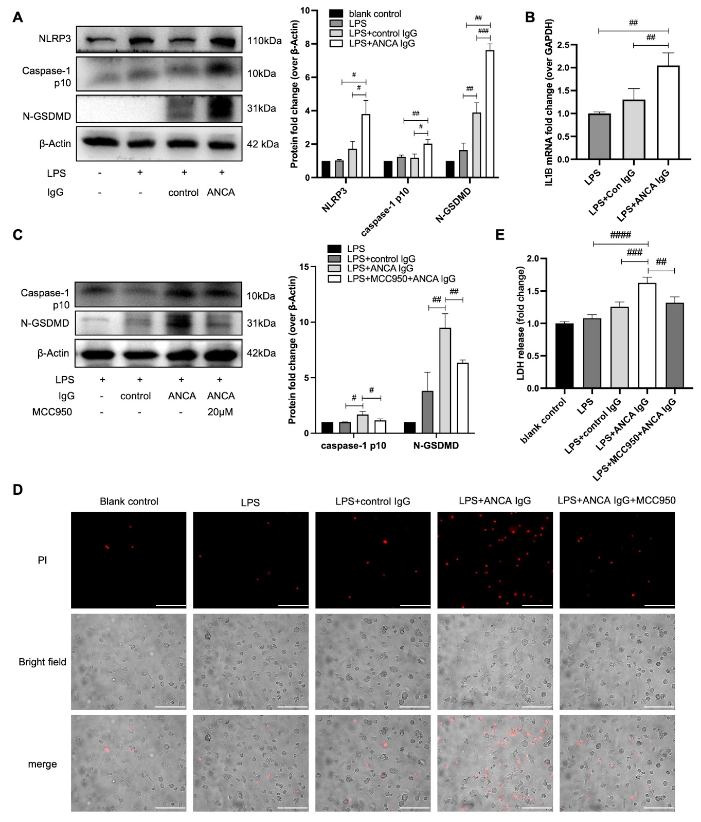NLRP3 inflammasome activity and pyroptosis are involved in CD206+ macrophage activation by MPO anti-neutrophil cytoplasmic antibodies