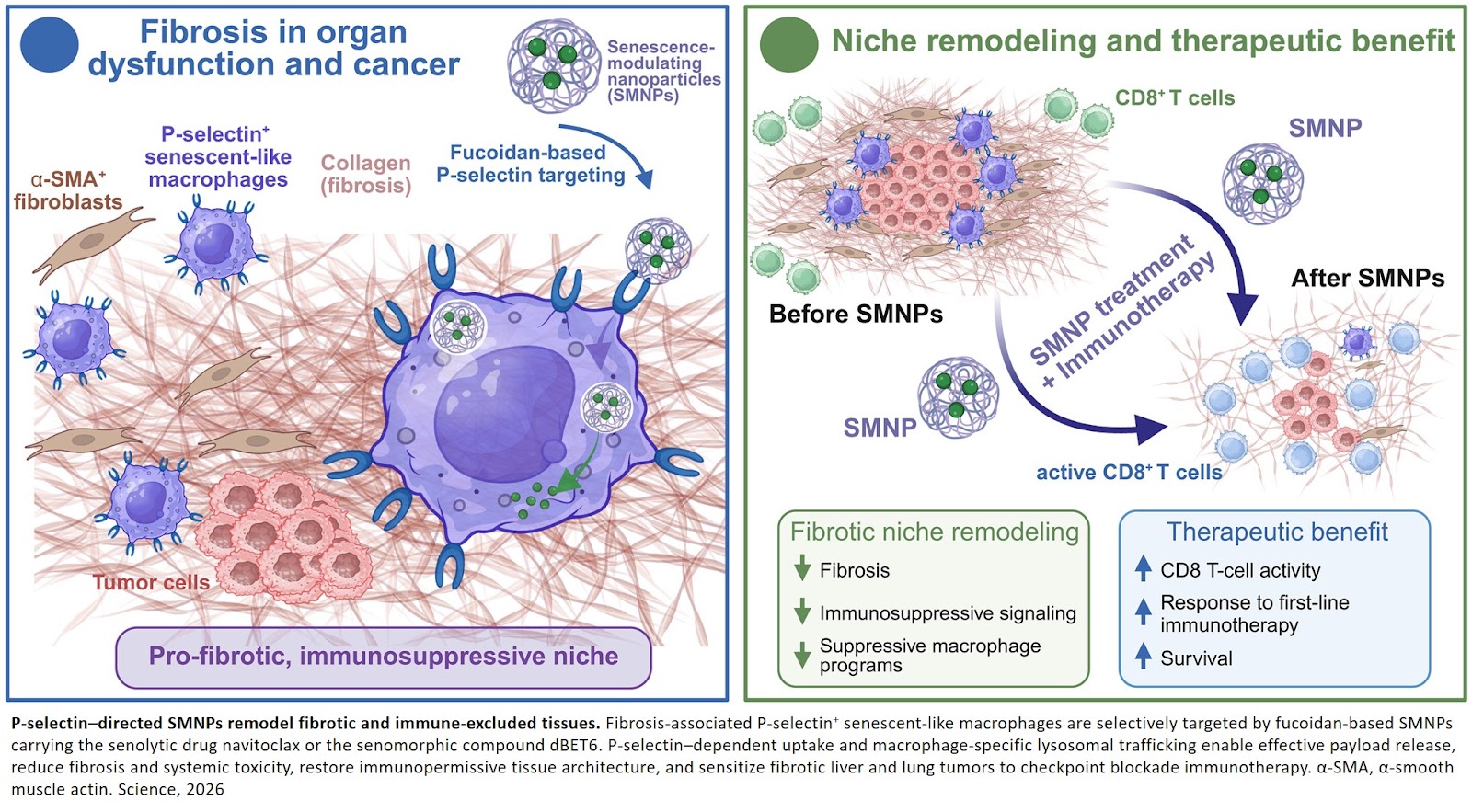 Ameliorating fibrosis in cancer via senescence-directed nanotherapy