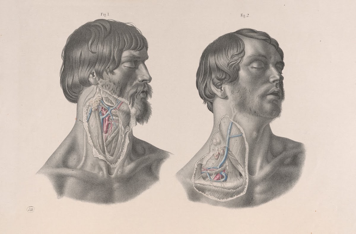 Surgical anatomy Pl07 1856