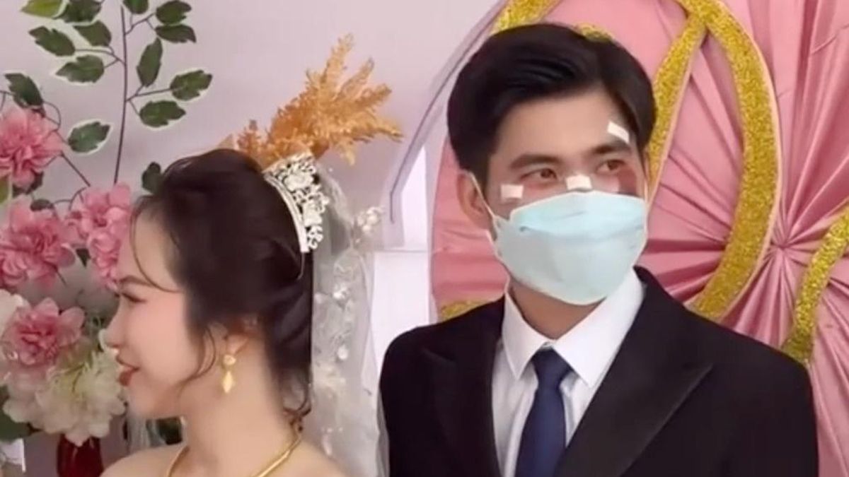 Chú rể đeo khẩu trang che mặt đầy vết thương trong ngày cưới - Tạp chí Tri thức