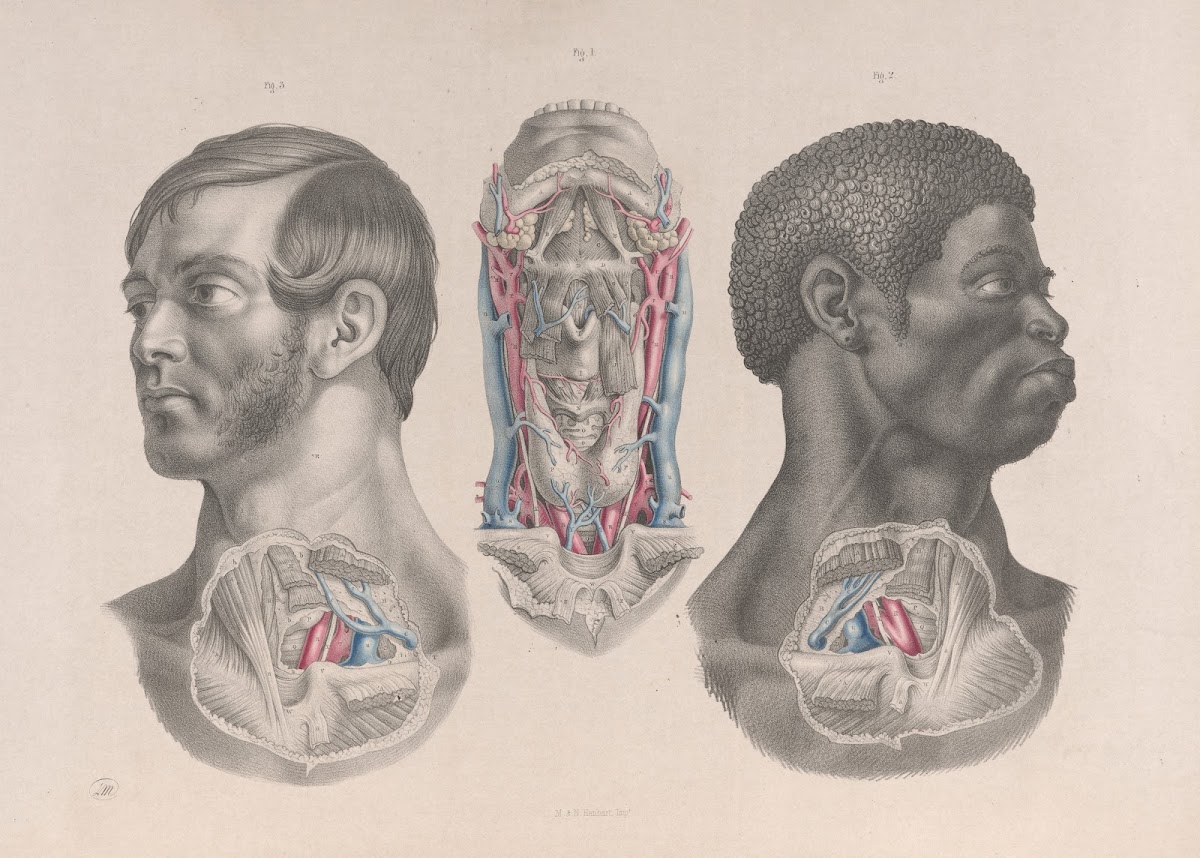 Surgical anatomy Pl04 1856