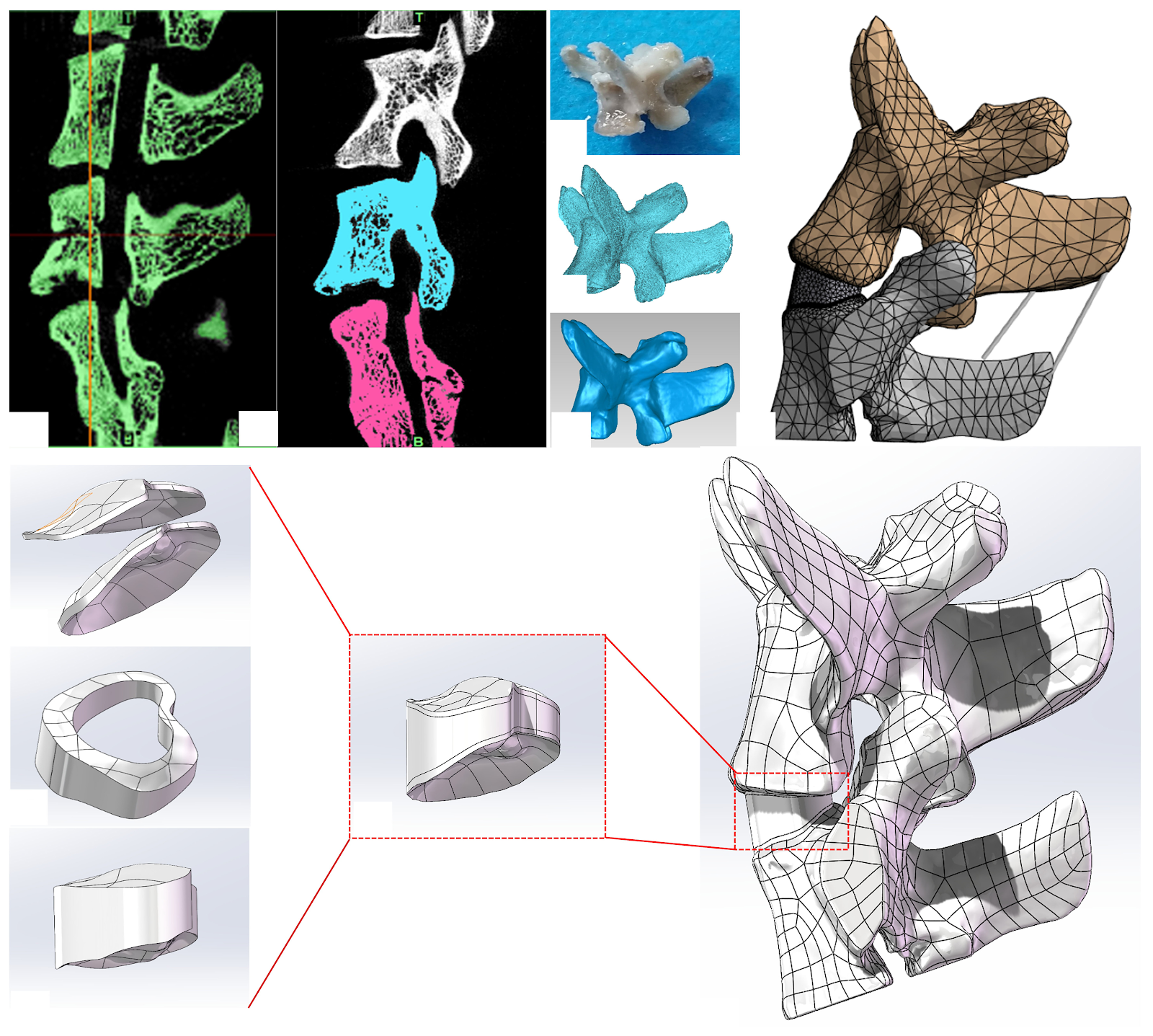 X-ray imaging and finite element analysis of the L6-S1 intervertebral disc in rats under abnormal forward-flexed posture