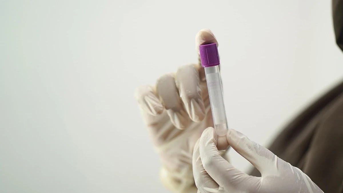 수면다원검사 절차와 비용 절감 방법