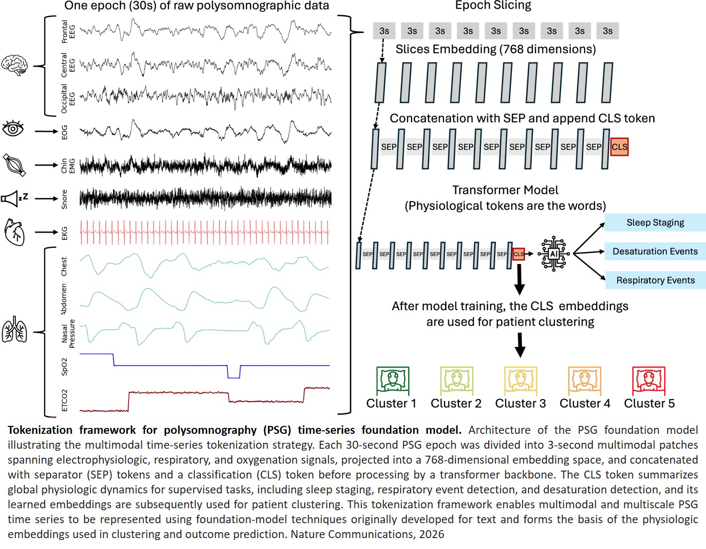 A foundation model for sleep identifies health risks