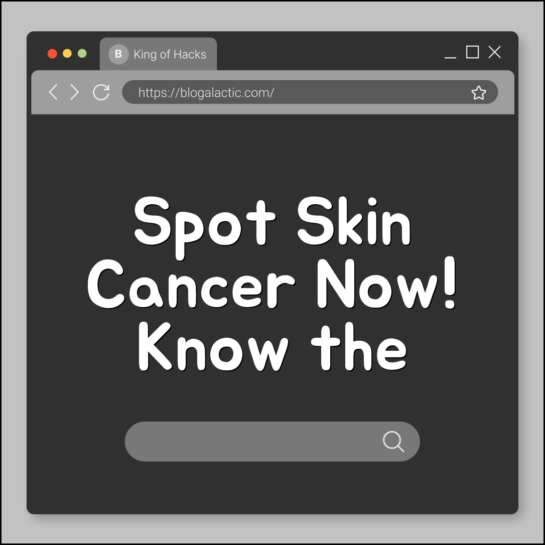 How to Spot Skin Cancer: The ABCDE Rule for Melanoma (mole check, dermatology exam, sun protection, biopsy)