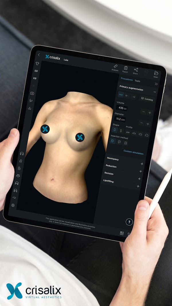 Un médecin regardant une simulation 3D d’un patient sur une tablette utilisant Crisalix. 1080px x 1920px.