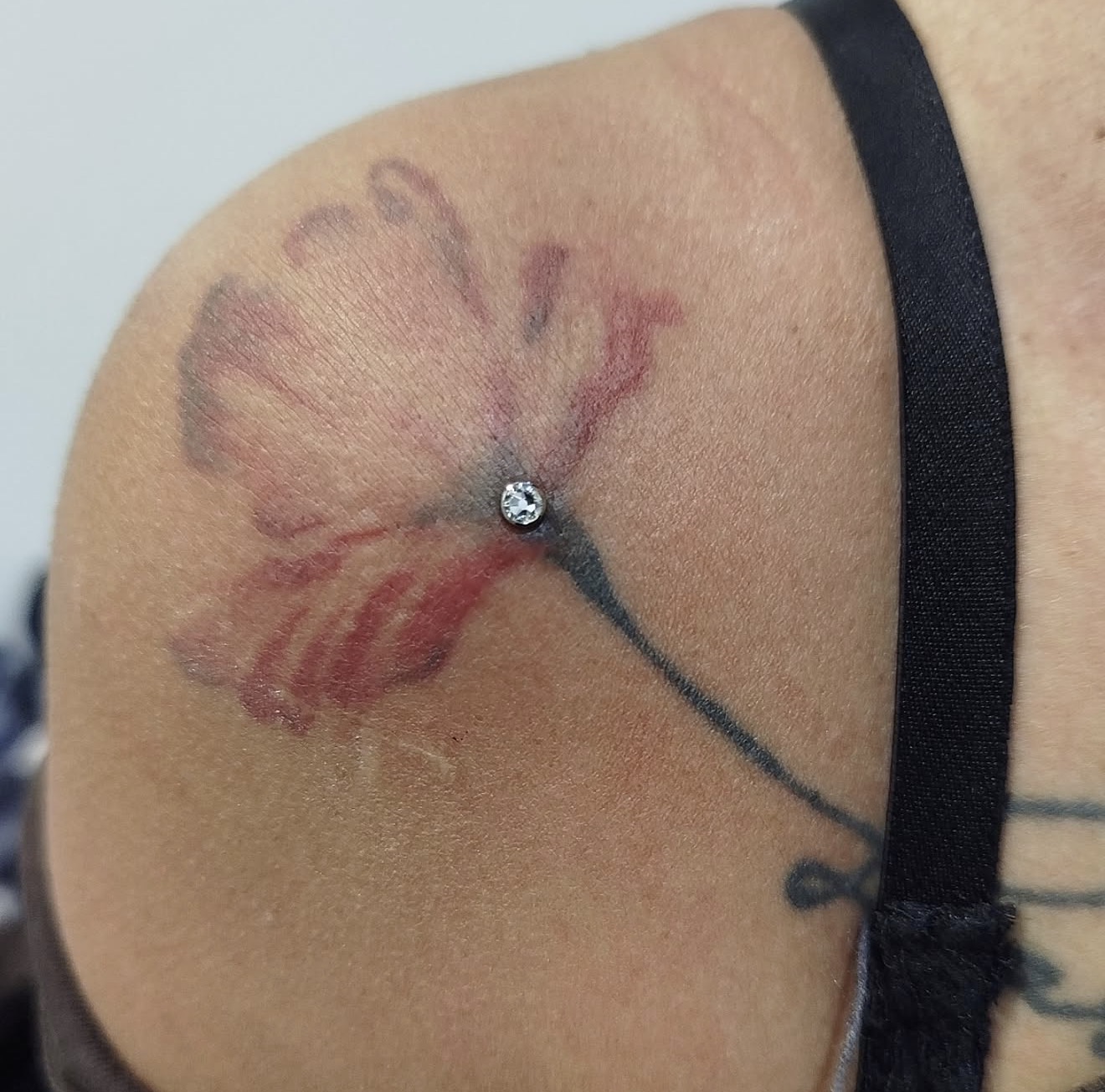 MICRODERMAL
