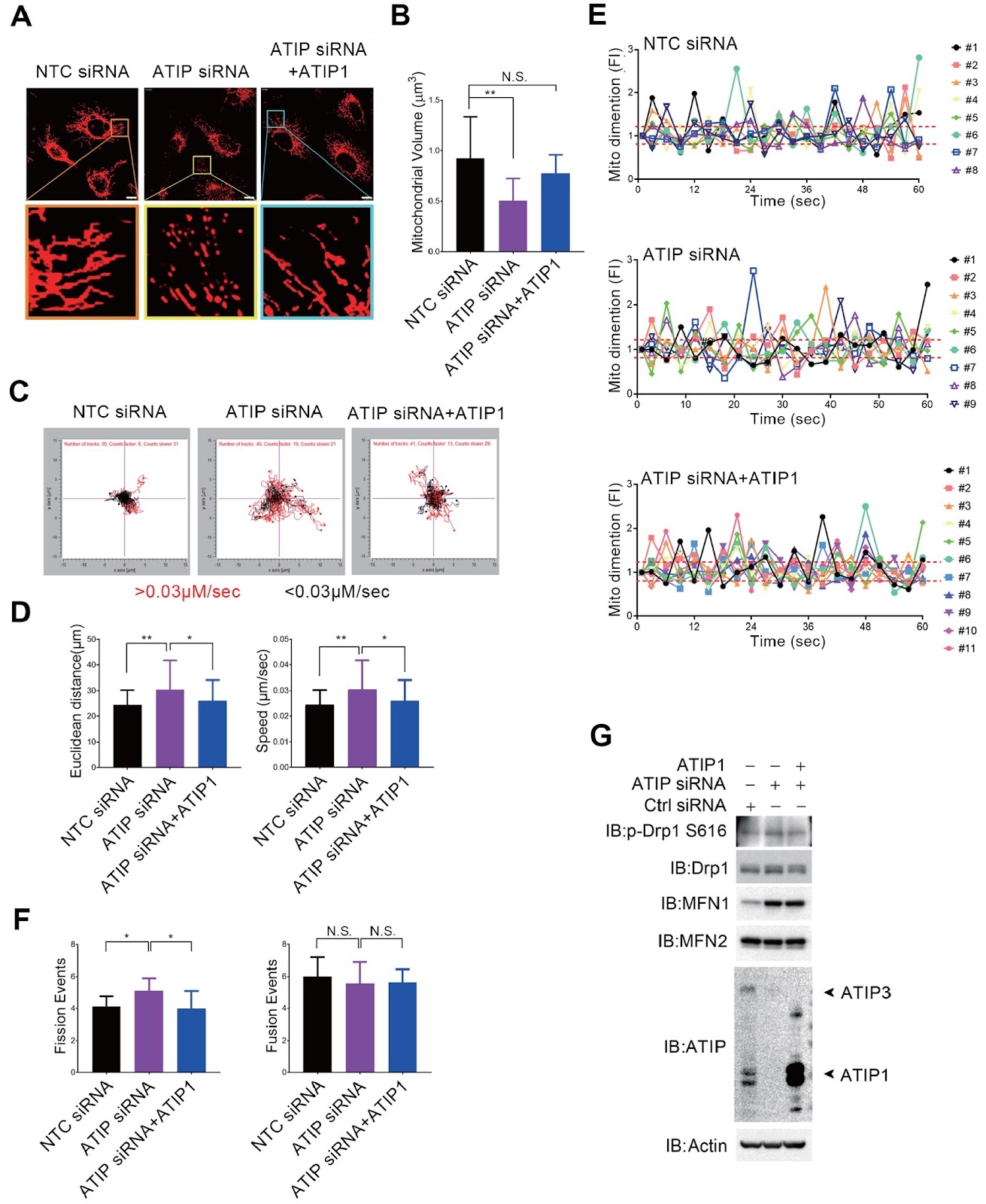 ATIP/ATIP1 regulates prostate cancer metastasis through mitochondrial dynamic-dependent signaling