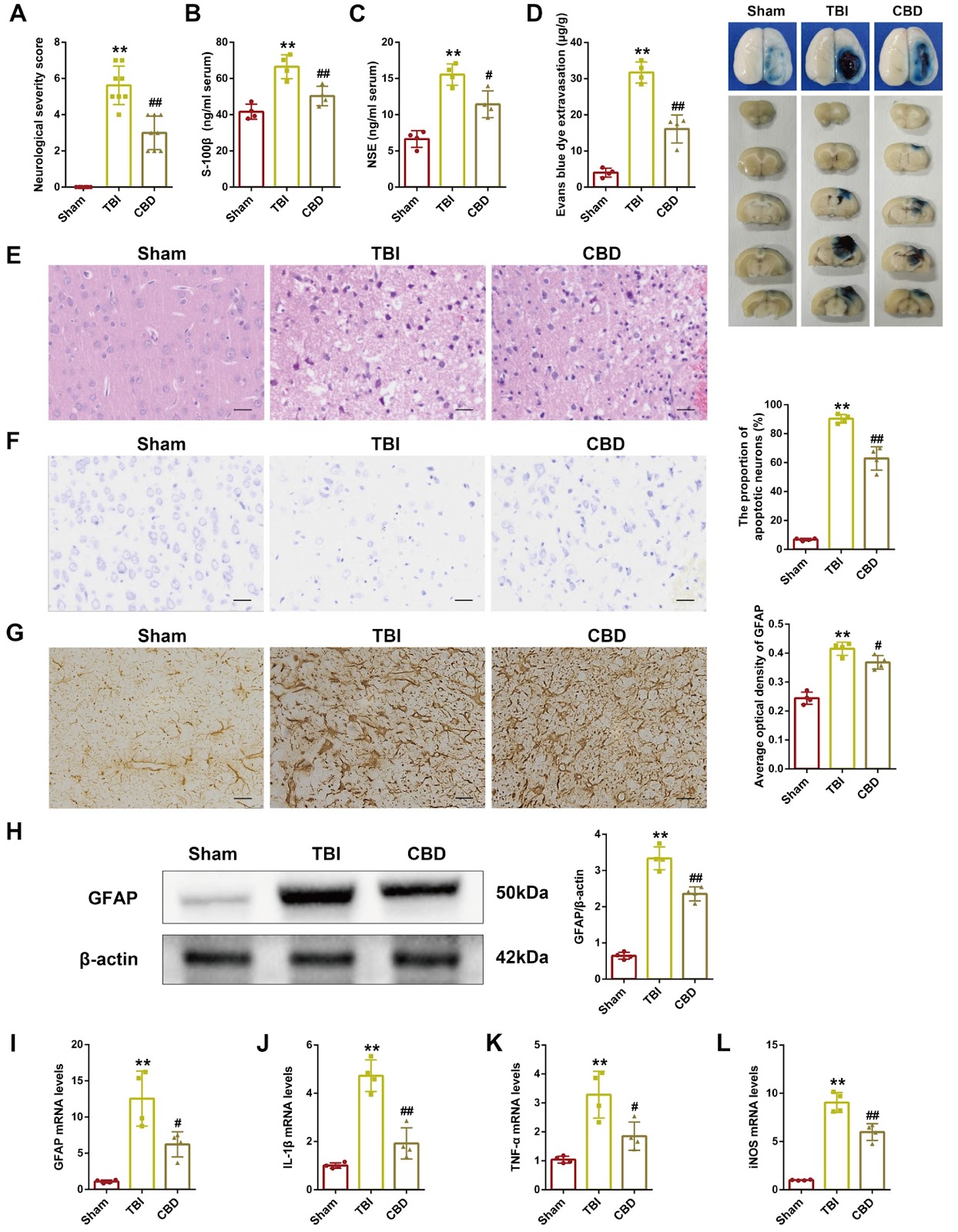 Cannabidiol alleviates the inflammatory response in rats with traumatic brain injury through the PGE2-EP2-cAMP-PKA signaling pathway