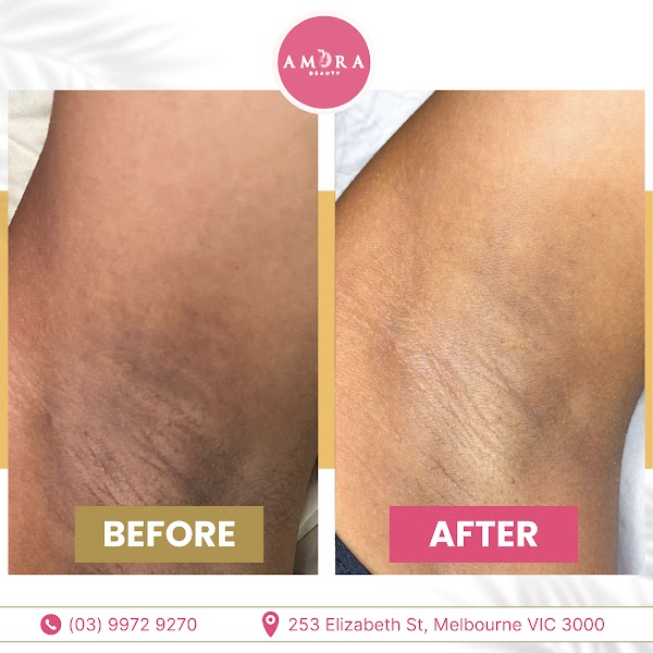 AMORA Nails & Beauty Melbourne CBD gallery photo 192